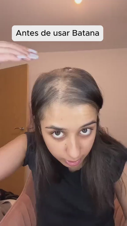 Aceite Capilar Fortalecimiento-anticaída Disaar Hair Care™